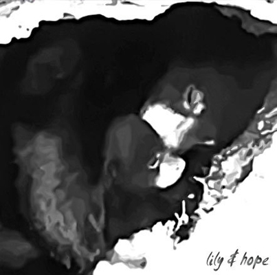 Lily & Hope - Jenny Lindell